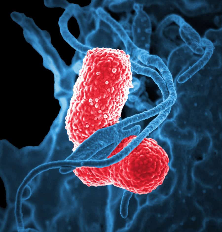 Gut Microbiome, Gut Health, Indigestion, Dyspepsia, Bloating, Gas, Acid Reflux, Burping
